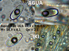 Anthracobia macrocystis