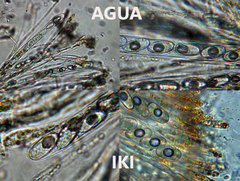 Anthracobia macrocystis