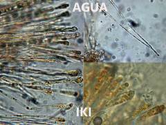 Anthracobia macrocystis