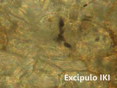 Anthracobia macrocystis