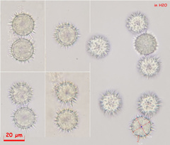 Ramsbottomia asperior