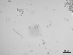 Hydrodictyaceae