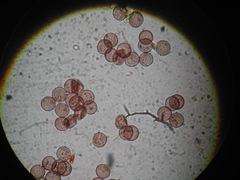 Paradiacheopsis rigida