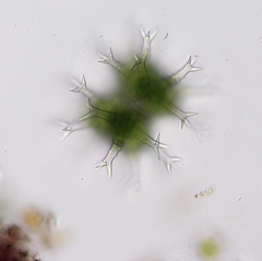 Staurastrum arctiscon