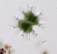 Staurastrum arctiscon