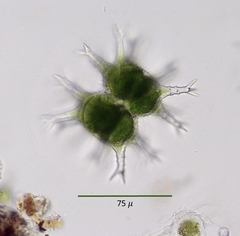 Staurastrum arctiscon