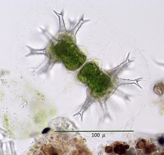 Staurastrum arctiscon