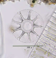 Staurastrum arctiscon