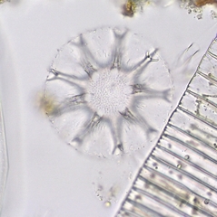 Staurastrum arctiscon