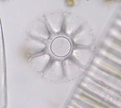 Staurastrum arctiscon