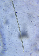 Spirogyra