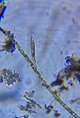 Spirogyra