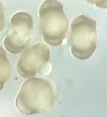 Chytridiomycota
