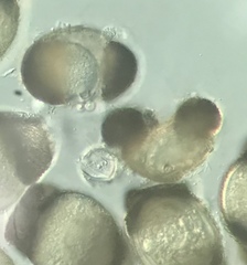 Chytridiomycota