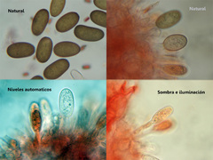 Botryosphaeria corticola