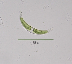 Closterium incurvum
