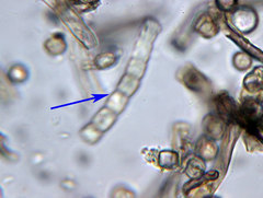 Coremiella cubispora