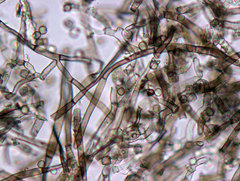 Coremiella cubispora