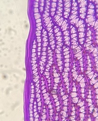 Sphagnum platyphyllum