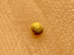 Caryomyia striolacrustum