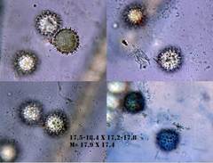 Scutellinia trechispora