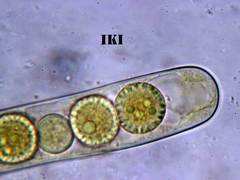 Scutellinia trechispora