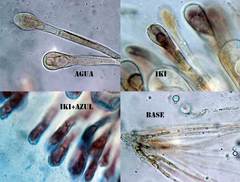 Scutellinia trechispora
