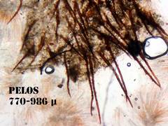 Scutellinia trechispora