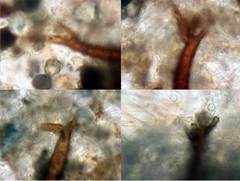 Scutellinia trechispora