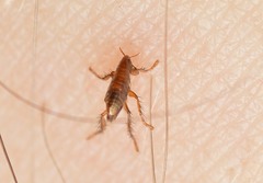 Siphonaptera