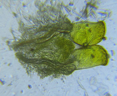 Cephalcia erythrogaster