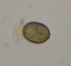 Trachelomonas hispida