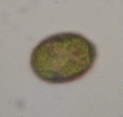 Trachelomonas hispida