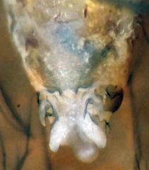Elipsocus obscurus