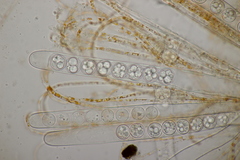 Pulvinula convexella