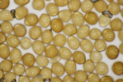 Puccinia calcitrapae