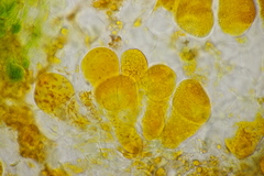 Coleosporium campanulae