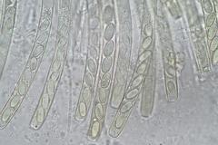 Peziza echinospora