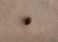 Rhyzobius litura