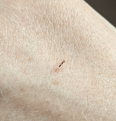 Coleosoma