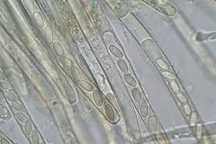 Peziza echinospora