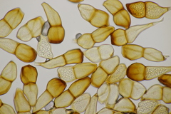Puccinia striiformis