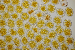 Puccinia striiformis