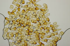 Puccinia striiformis
