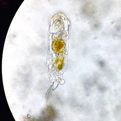 Cephalodella forficula