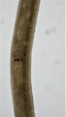 Prostoma