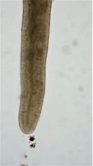 Prostoma