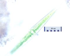 Closterium rostratum