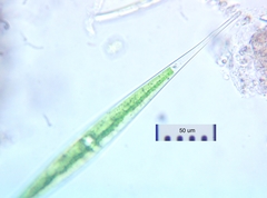Closterium rostratum