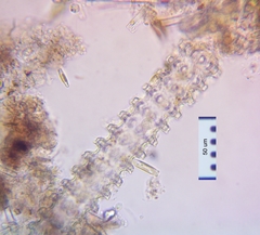 Triploceras verticillatum